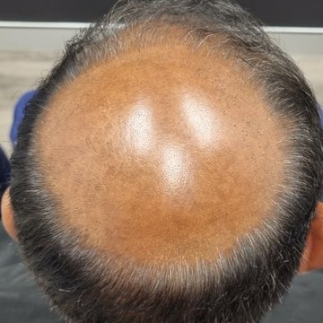 The same client before Tuffs