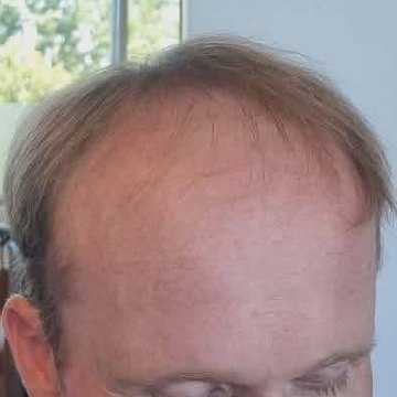 The same client before Tuffs