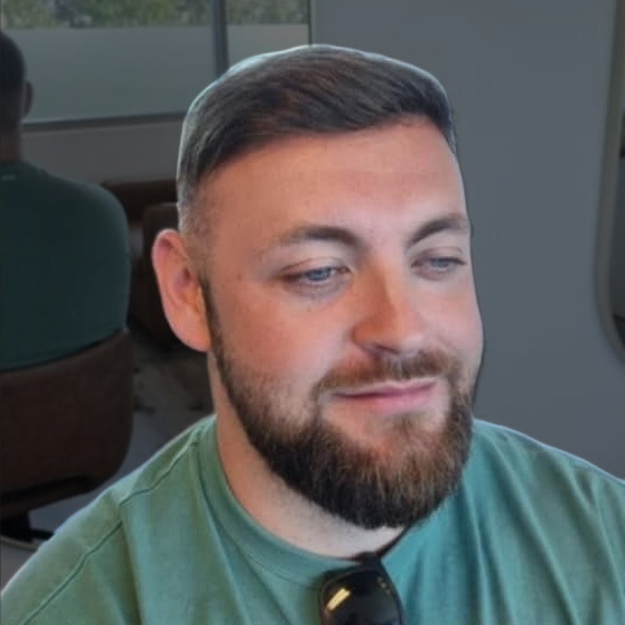 Close-up of a client's hairline after their Tuffs hair system