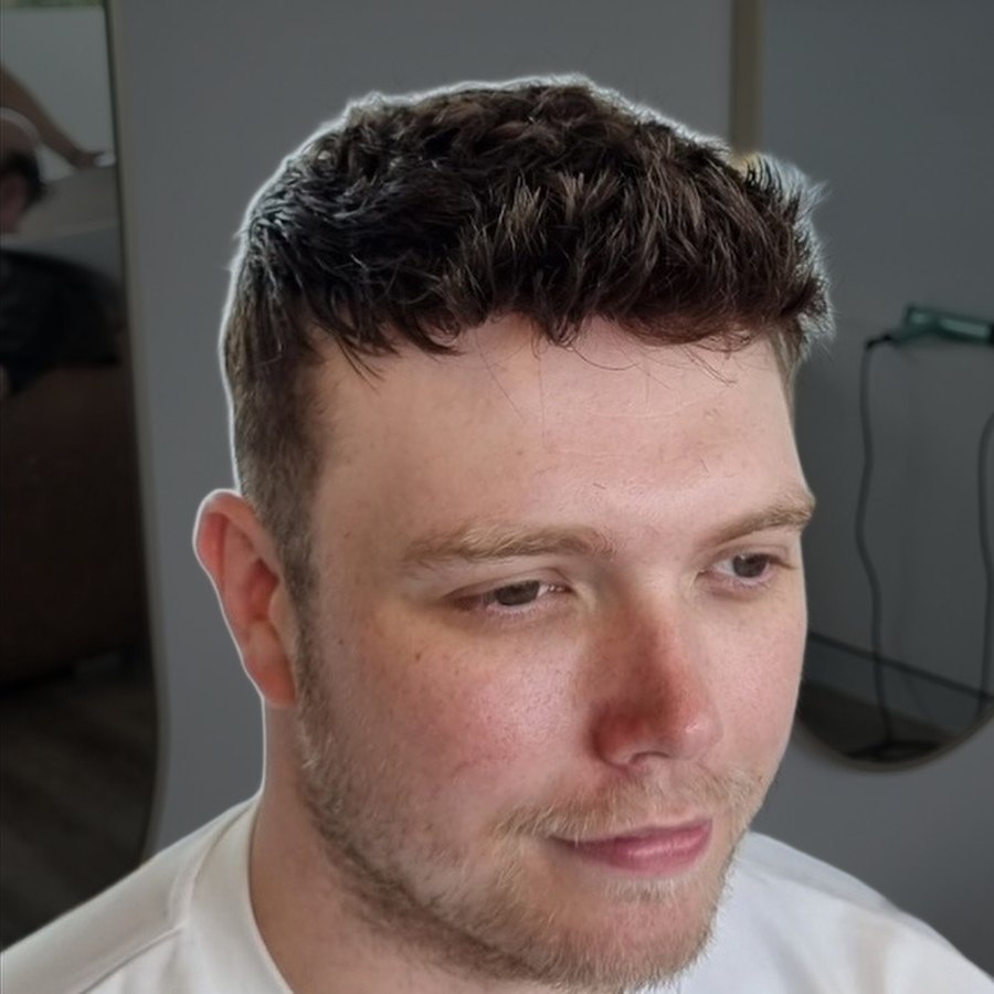 Close-up of a client's hairline after their Tuffs hair system