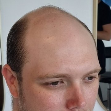 The same client before Tuffs