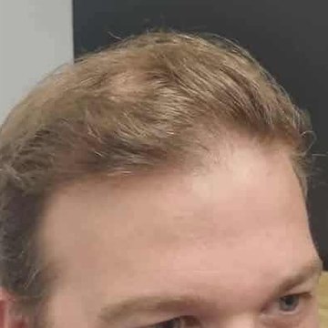 The same client before Tuffs